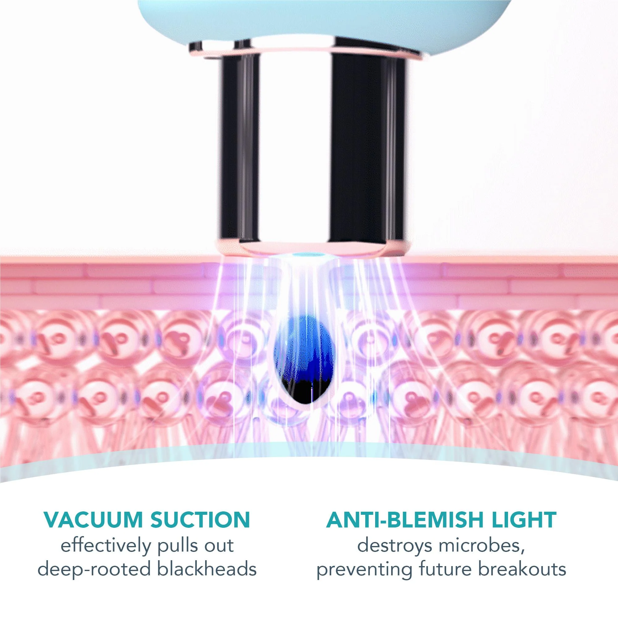 Foreo Kiwi Blackhead Pore Vacuum (Mint) - Image 6