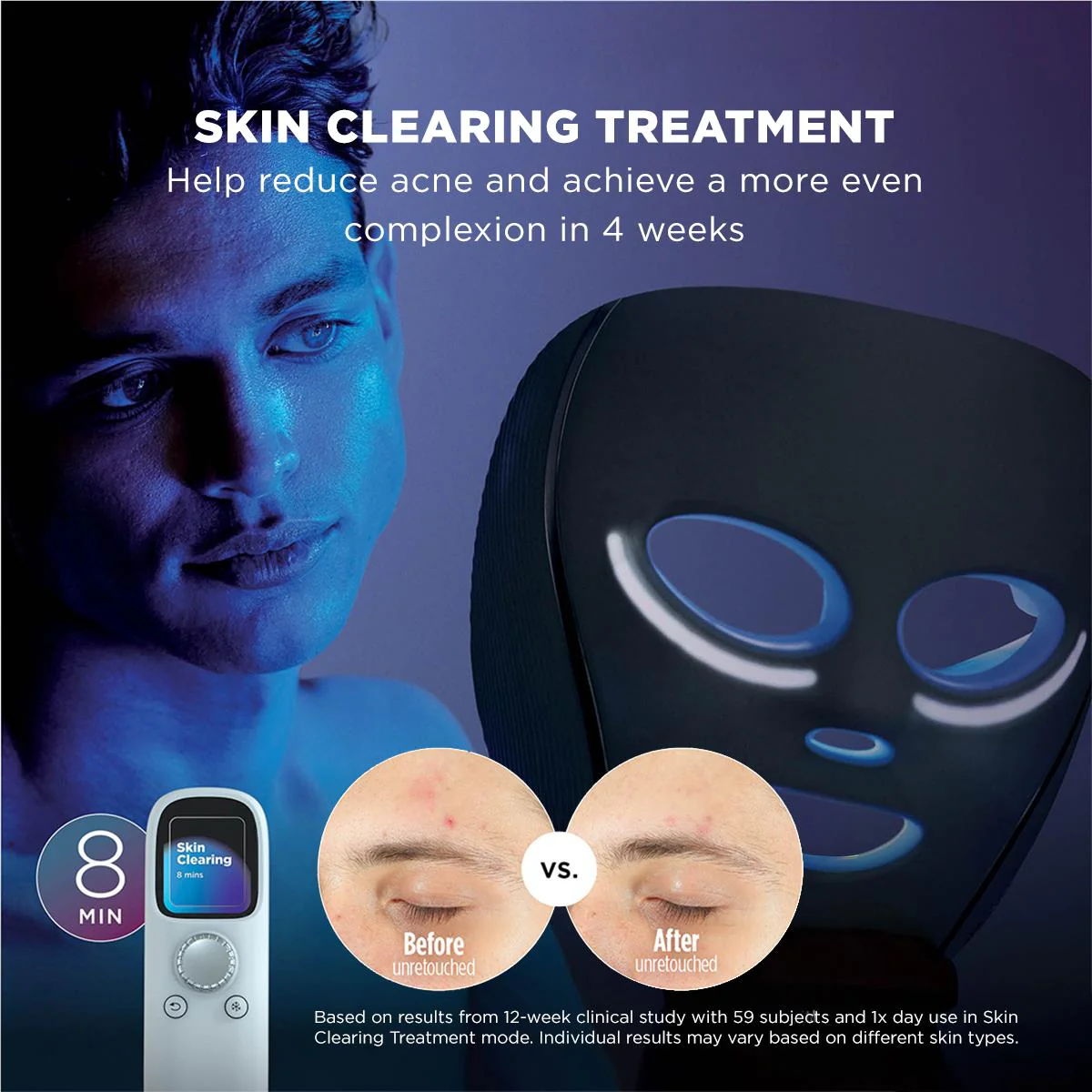 Shark™ CryoGlow™ Cooling + LED Face Mask (Blue Frost) - Image 6